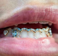 Grillz For Women, Teeth Jewellery, Teeth Jewels, Tooth Jewelry, Bling Bows, Dope Jewelry Accessories