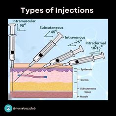 an image of different types of injections