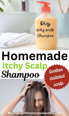 Soothe irritated, dry and itchy scalp. Learn how to make diy shampoo for itchy scalp at home. Also learn reasons for itchy scalp. Natural hair care recipes. Homemade shampoo recipes. Itchy scalp remedies. Itchy Dry Scalp Remedy, Remedies For Itchy Scalp, Itchy Scalp Shampoo, Make Shampoo, Itchy Scalp Remedy, Natural Shampoo Diy, Homemade Shampoo Recipes, How To Make Shampoo, Diy Hair Care Recipes