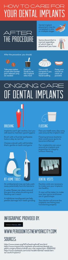 Dental implant placement can be completed in one or multiple stages. Patients normally experience some discomfort, regardless of which type of placement they have. Take a look at this NYC periodontist infographic for more dental implant facts! Poster Presentation Ideas, Dental Poster, Dental Images, Photo Facts, Poster Presentation, Dental Posts, Dental Posters