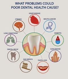 Dental health involves the whole body. Keeping good dental hygiene and seeing your dentist often can help you maintain health over all! Feel free call us anytime with questions & to schedule your appointments! Oral Health Education, Dental Decay, Kedokteran Gigi, Dental Health Care, Dental Implants Cost, Dental Bridge, Teeth Health