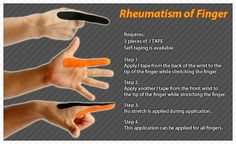 Kinesiology taping instructions for rheumatism of the finger #ktape #ares #finger #rheumatism Joints Pain Relief, Medical Prescription, Disease