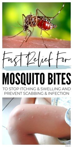 mosquito bites on someone's arm with the words, fast relief for mosquito bites to stop