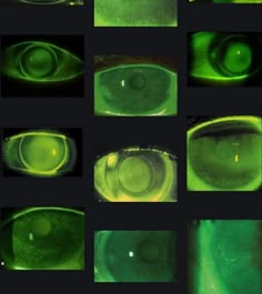 several images of the inside of an eye with green light coming from one side and another part of the viewer's lens