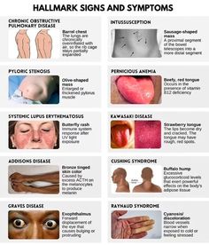 the different types of signs and symptoms in human body, with description on each side