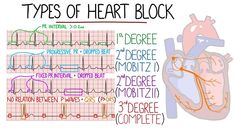 a diagram of the heart with different types of heartbeats and their corresponding functions in each section