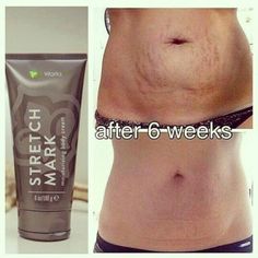 Got Stretch Marks?????? Here is your solution!!!!  http://www.facebook.com/itworksbyshannonshores Stretch Mark Cream, Stretch Mark, Baby 2, Post Baby