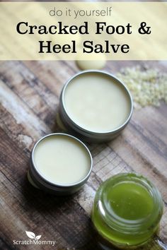 A super simple, crazy effective DIY Cracked Foot and Heel Salve Recipe which will absolutely get your feet ready for spring and summer. Get the recipe here! Herbal Salves, Diy Health, Beauty Recipe, Diy Skin Care