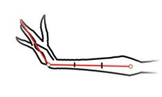 a drawing of a pair of scissors cutting through the red line