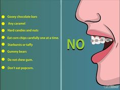 Things to avoid when wearing braces! Things To Eat With Braces, Braces Diet, Brace Tips, Dental Braces Colors, Invisible Teeth Braces, Braces Pain, Cute Braces Colors