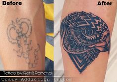 before and after photos of tattoo removals by roni pancha at crazy addition studios