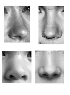 four different angles of the nose