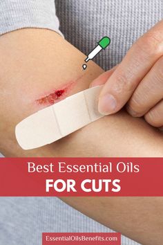 Treat minor cuts and scrapes naturally with essential oils! Discover how lavender, tea tree, and frankincense oils can disinfect wounds, reduce inflammation, and promote faster healing. Learn safe application methods and easy DIY first-aid recipes in this guide. #EssentialOils #NaturalFirstAid #WoundHealing #CutsAndScrapes #HolisticHealth #AromatherapyBenefits #DIYRemedies #HealingNaturally Essential Oil For Cuts, On Guard Essential Oil, Essential Oils For Congestion, Essential Oils For Cough, Oils For Sore Throat, Essential Oil Education, Natural Girl, Essential Oils 101