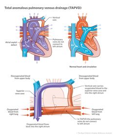 two diagrams showing the stages of heart valves and their corresponding blood vessels, including an ovar