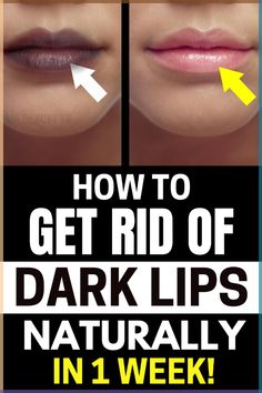 Lips of varying shades and colors are a natural occurrence, but hyper-pigmentation may cause cosmetic and health problems. Instead of using chemical treatments or pharmaceuticals, most people find that using natural and organic remedies is all that's needed to get rid of this discoloration for good. If your lips have become too dark, continue reading to discover how to naturally lighten them. Here are 4 Natural Remedies to Lighten Dark Lips at home!#beautytips#darklips#lipsremedy Pigmentation Remedy, Remedies For Dark Lips, Lighten Dark Lips, Remedies For Dry Mouth, Lip Lightening, Dark Armpits, Dark Underarms, Pigmented Lips, Dark Lipstick