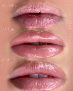 Lip Blushing Tattoo Before And After Natural, Restalyne Kysse Lips, Pmu Lips Permanent Makeup, Healed Lip Blush, Lip Blushing Before And After, Permanent Lip Color Tattoo, Lip Blushing Tattoo Colors, Lip Blushing Tattoo Before And After, Lip Shading