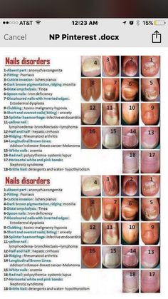 Nail Disorders, Nephrotic Syndrome, Folk Medicine, Health Chart, Medical School Essentials, Braid Hairstyle, Medical Anatomy, Medical Studies