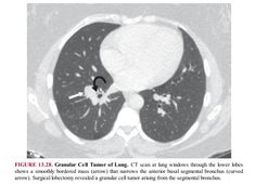 an x - ray image shows the location of the lungs in this case, as well as