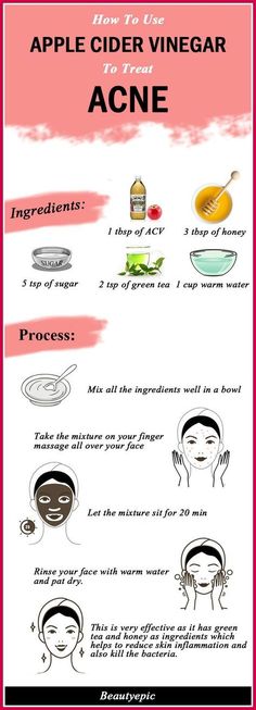 Get Rid Of Acne Fast, Apple Cider Vinegar Acne, Rid Of Acne, Acne Scar Removal, Smink Inspiration, Baking Soda Shampoo, Scar Removal