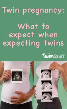 two pregnant women with their stomach exposed and the words twin pregnancy what to expect when expecting twins