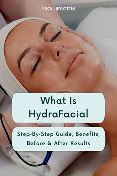 Hydrafacial • The Complete Guide Hydrafacial Step By Step, Hydro Facial Before And After, Hydro Facial Benefits, Hydrafacial Steps, Hydra Facial Before And After, Hydrafacial Machine, Hydra Facial Benefits, At Home Hydrafacial, Hydrating Facial