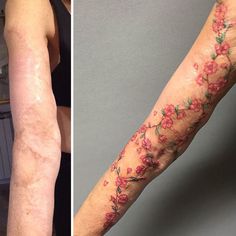 a woman's arm with flowers on it and an image of the before and after