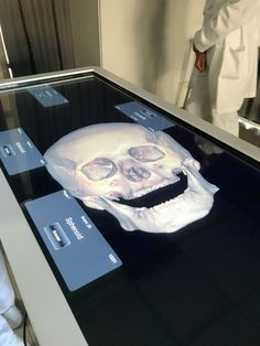 there is a fake human skull on display