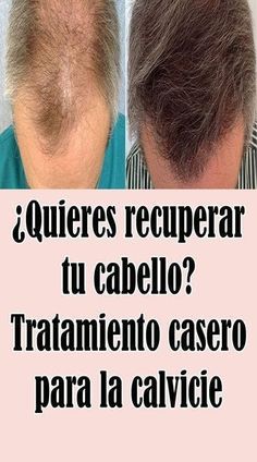 El truco genial para quitar la grasa de los muebles de la cocina - Doctor Consejos - Medium Thicker Hair Naturally, Get Thicker Hair, Hair Care Remedies, Hair Nutrition, How To Get Thick, Beauty Tips For Hair, Hair Remedies, Hair Food