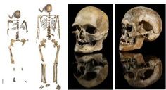 three different views of the same human skeleton