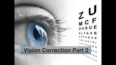 Organ System, Eye Exercises, Eye Sight Improvement, Vision Eye, Healthy Eyes, Care Logo, Eye Health, Eye Care, Ayurveda