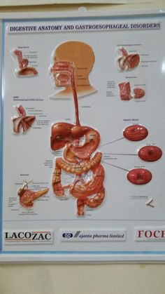 a diagram of the digest and gastrophaical disorders on a white board