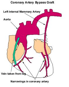 the anatomy of the heart and its major vessels, including the coronasyl artery