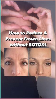 ✨Instead of getting botox try these face yoga techniques to reduce and prevent the 11s between the brows.✅ Pinch deep into the procures muscle located between the brows and hold for 30 seconds, 2... Brow Wrinkles, Natural Wrinkle Reducer, Facial Aging, Holistic Skin Care, Face Yoga Exercises, Yoga Techniques, Release Tension, Facial Wrinkles, Forehead Wrinkles