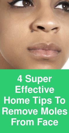 4 Super-effective home tips to remove moles from face They are dark brown or black in color. They may be one or cluster. They can be smooth or hairy. They might lie flat on skin or may be raised. How ever they are, we hate moles on our face. So I am going to tell you 4 super-effective ways to get rid of them. 1: … How To Remove Moles, Remove Moles, Warts On Hands, Warts On Face, How To Remove Warts, Remove Warts, Skin Moles, Skin Growths, Mole Removal