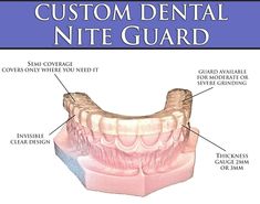 Do you grind or clench your teeth?. Our guards are custom fitted, latex and BPA-free, made in the USA and will be designed especially for. DENTAL NIGHT GUARD. custom nightguard custom night guard dental mouthguard dental mouth guard nightguard night guard. Dental Retainer, Night Guard, Talking Behind Your Back, Drugstore Products, Teeth Grinding, Sick Remedies, Stomach Problems, Receding Gums