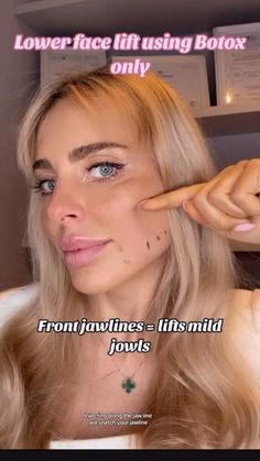 Botox Face Lift, Botox For Jowls, Botox On Jawline, Botox Placement, Lip Flip Botox Before And After, Lower Face Botox Before And After, Botox Video Injections, Botox Business