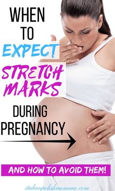 When to expect stretch marks during pregnancy! So many mothers ask when do stretch marks start to show and how can I avoid them? Here is how I prevented stretch marks through 3 pregnancies and how you can avoid stretch marks too! Timing and application of stretch mark cream is everything! #pregnancy #pregnancytips #maternity #baby #babies #momtips #motherhood #stretchmarks #stretchmarkprevention #pregnancystretchmarks Stretch Mark Prevention, Stretch Mark Cream, Stretch Mark, Morning Sickness, First Pregnancy, First Trimester