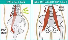 Psoas Muscle Pain, Psoas Iliaque, Hata Yoga, Tracy Anderson, Muscle Pain Relief, Yoga Iyengar