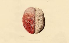 an image of two halves of the same human brain, one with red and white markings