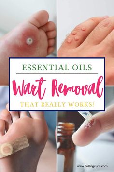 Discover the power of essential oils for wart removal! Using tea tree, oregano, apple cider vinegar and more, we can create a DIY home remedy to banish those unsightly warts. Don't let warts bother you any longer, try this natural remedy today! via @pullingcurls Wart Essential Oil, Essential Oil Wart Remover, Essential Oils For Warts, Essential Oils Warts, Water Warts, Natural Wart Remedies, Home Remedies For Warts, Wart Remover