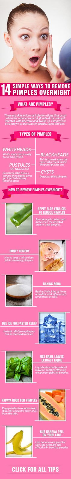 Pimples can make you feel less confident and take a toll on you mentally. But why worry when you can get rid of pimples with simple remedies. Check them out now! Pimple Types, Remove Pimples Overnight, Overnight Skin Care, Skin Moles, Acne Overnight, Pimples Overnight, Skin Growths, How To Get Rid Of Pimples, How To Remove Pimples