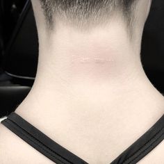 the back of a man's neck with a pink spot on his left side