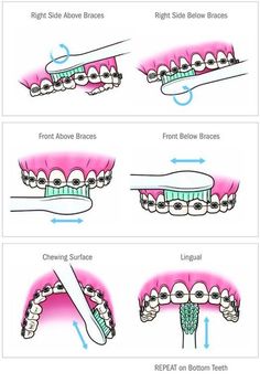 Haut Routine, Kedokteran Gigi