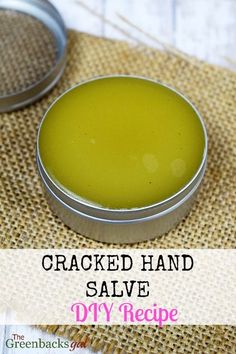 An easy to make DIY cracked hand salve that really works on dry, rough winter hands. Makes an excellent gift too. Hand Cream Homemade, Salve Recipes, Hand Salve, Cracked Hands, Diy Lotion, Diy Kosmetik, Homemade Lotion, Hand Creams, Diy Recipe