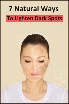 Wrinkles Under Eyes, Natural Wrinkle Remedies, Dark Spots Remedies, Anti Aging Remedies, Wrinkle Remedies, Wrinkle Free Skin, Dark Spots On Face, Dark Spots On Skin, Lighten Dark Spots