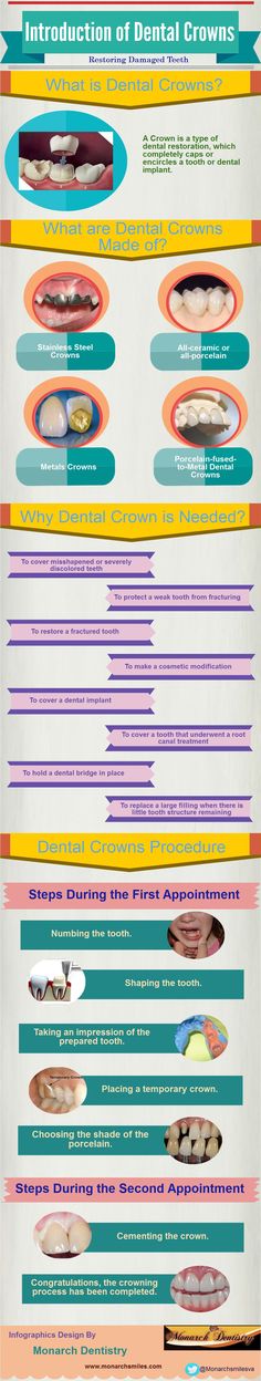 Introduction of Dental Crowns Crown Preparation Dental, Dental Crown Procedure, Dental Tips For Pregnant Women, Ethics In Dentistry, Dental Restoration, Cosmetic Dentistry Procedures, Discolored Teeth, Dental World, Dental Facts