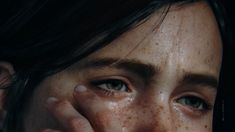 a woman with freckles on her face holding her hands to her face and looking at the camera