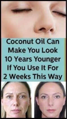 Get Rid Of Wrinkles, Wrinkle Free Skin, Dark Spots On Face, Natural Face Skin Care, Skin Care Wrinkles, Spots On Face, Coconut Oil For Skin, Face Wrinkles, Natural Skin Care Routine