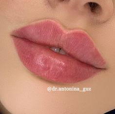 Russian Lips Filler, Ideal Lips, Desired Lips, Russian Lips, Lip Surgery, Heart Shaped Lips, Burgundy Lipstick