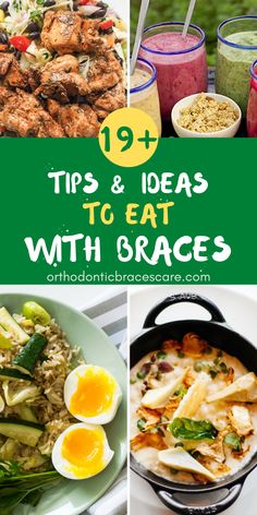 How To Eat With Braces - 19+ Ideas: Braces wearers need to change food habits with braces. Let's know about all the foods you can eat or not with braces. Things To Eat After Getting Braces, Dinner Ideas For Braces Soft Foods, Foods To Eat With Braces Soft, Meals For New Braces, Soft Foods After Braces Ideas, Easy Meals For Braces, Braces Food Ideas Meals